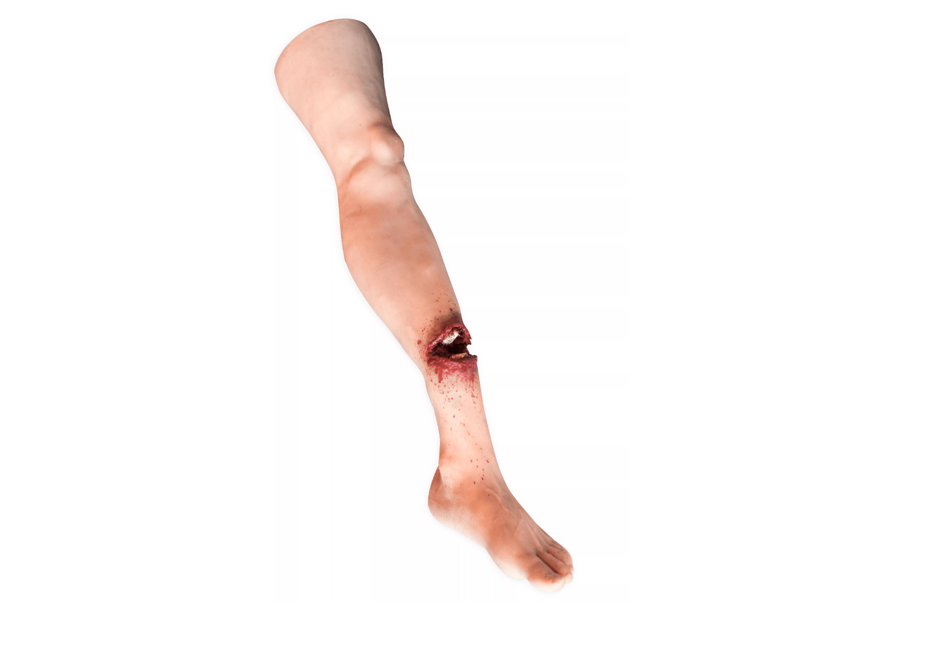 Bein mit offenem Bruch Task Trainer - Erler - Zimmer